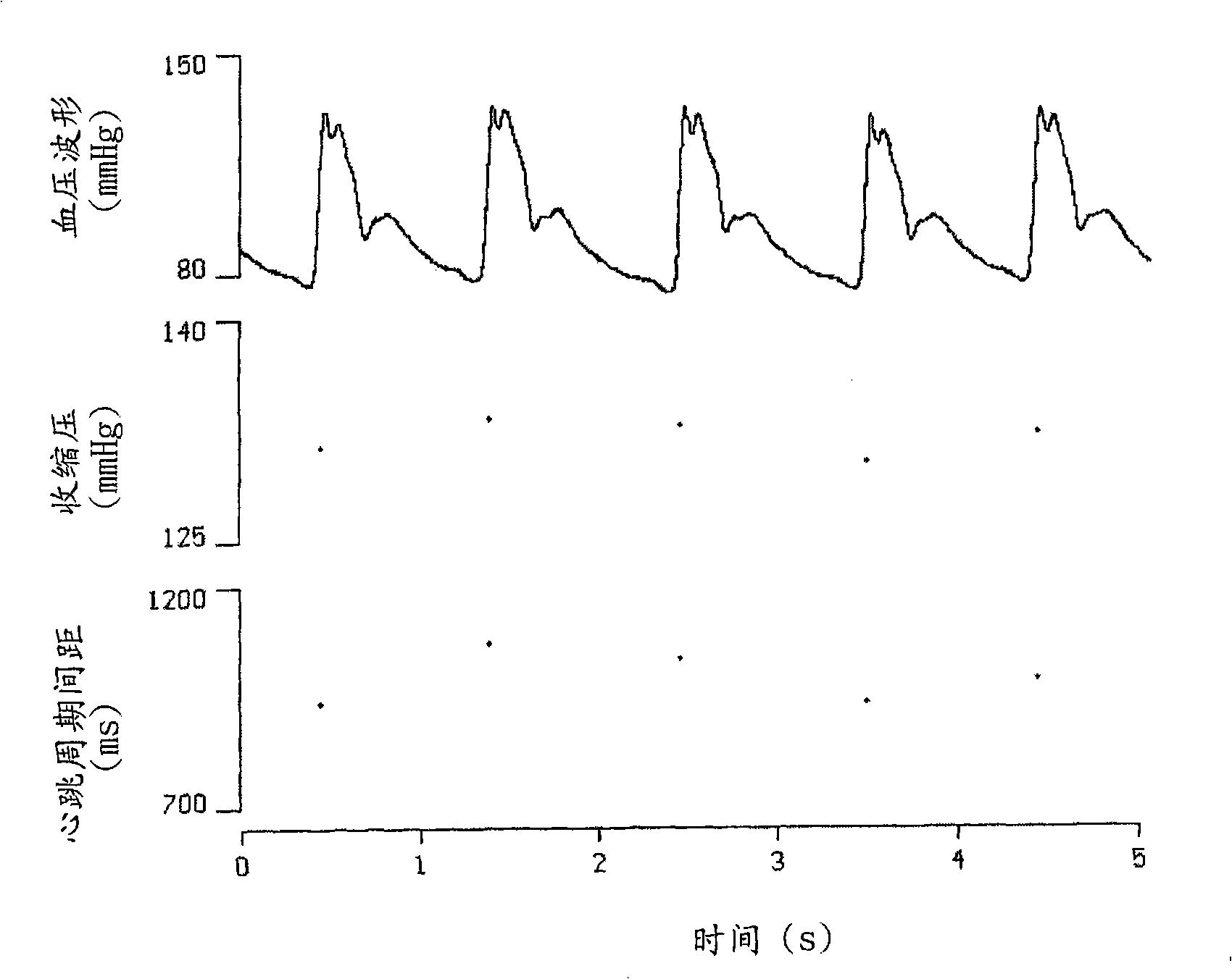 Analytic system and method of traditional Chinese medicine pulse diagnosis