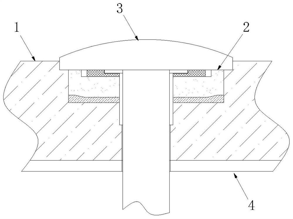 Biological activity glass material broken bone connector used for bone fracture surgery, and use method of biological activity glass material broken bone connector