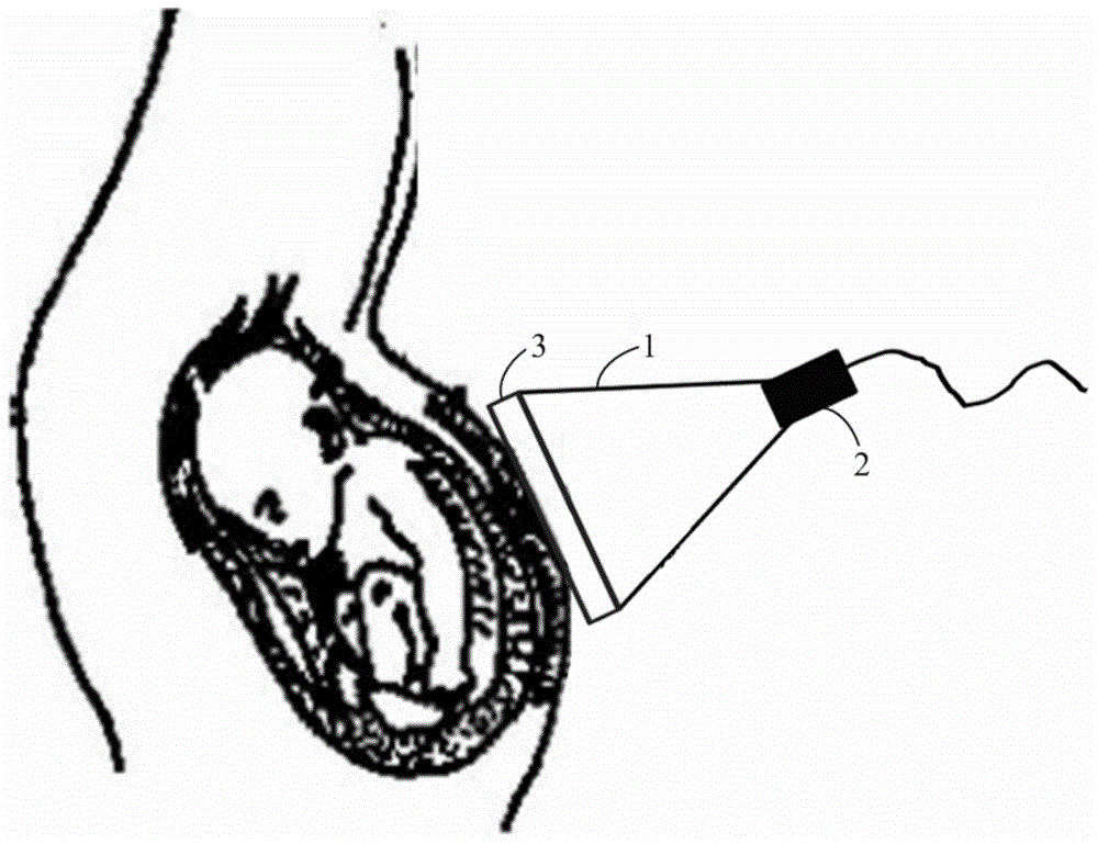 Fetal heart sound signal detection and processing device