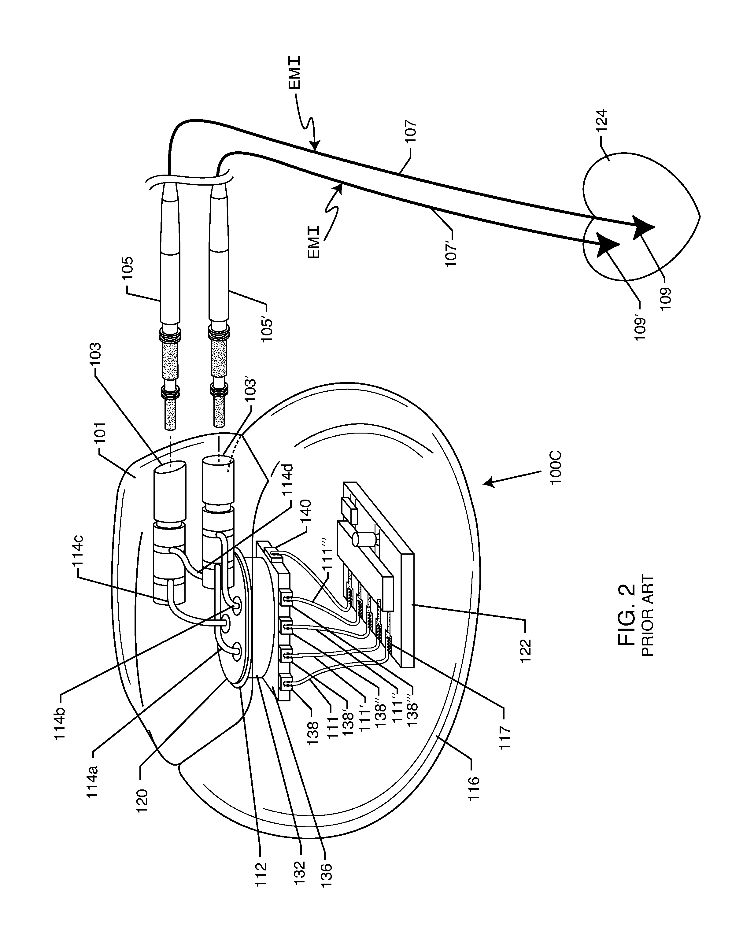 Low inductance and low resistance hermetically sealed filtered feedthrough for an aimd