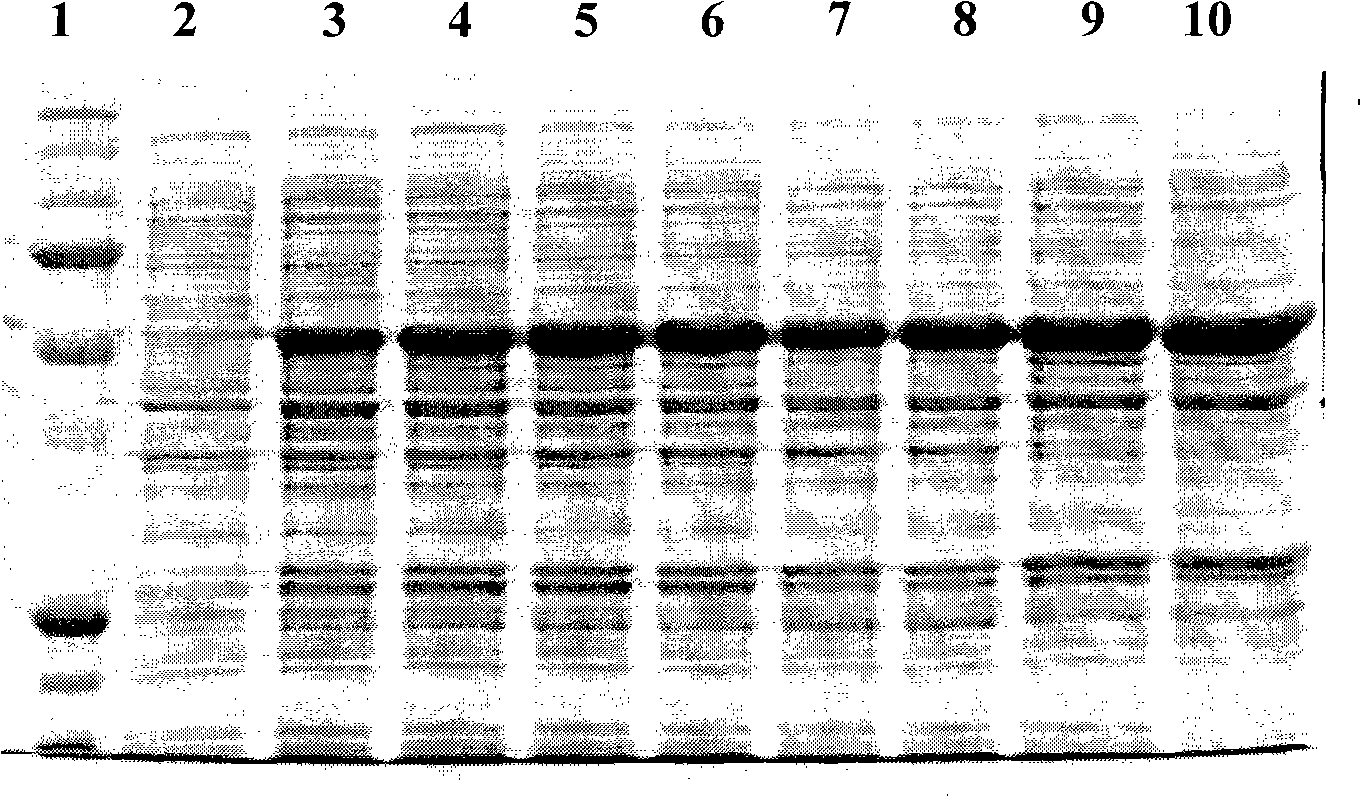 Antihuman SCGN monoclone antibody, preparation, application and hybrid tumor cell strain