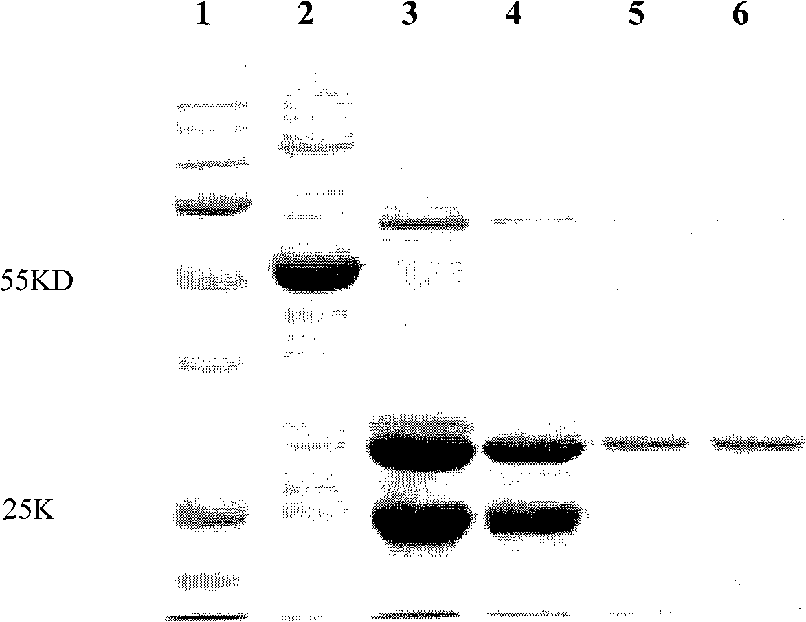 Antihuman SCGN monoclone antibody, preparation, application and hybrid tumor cell strain