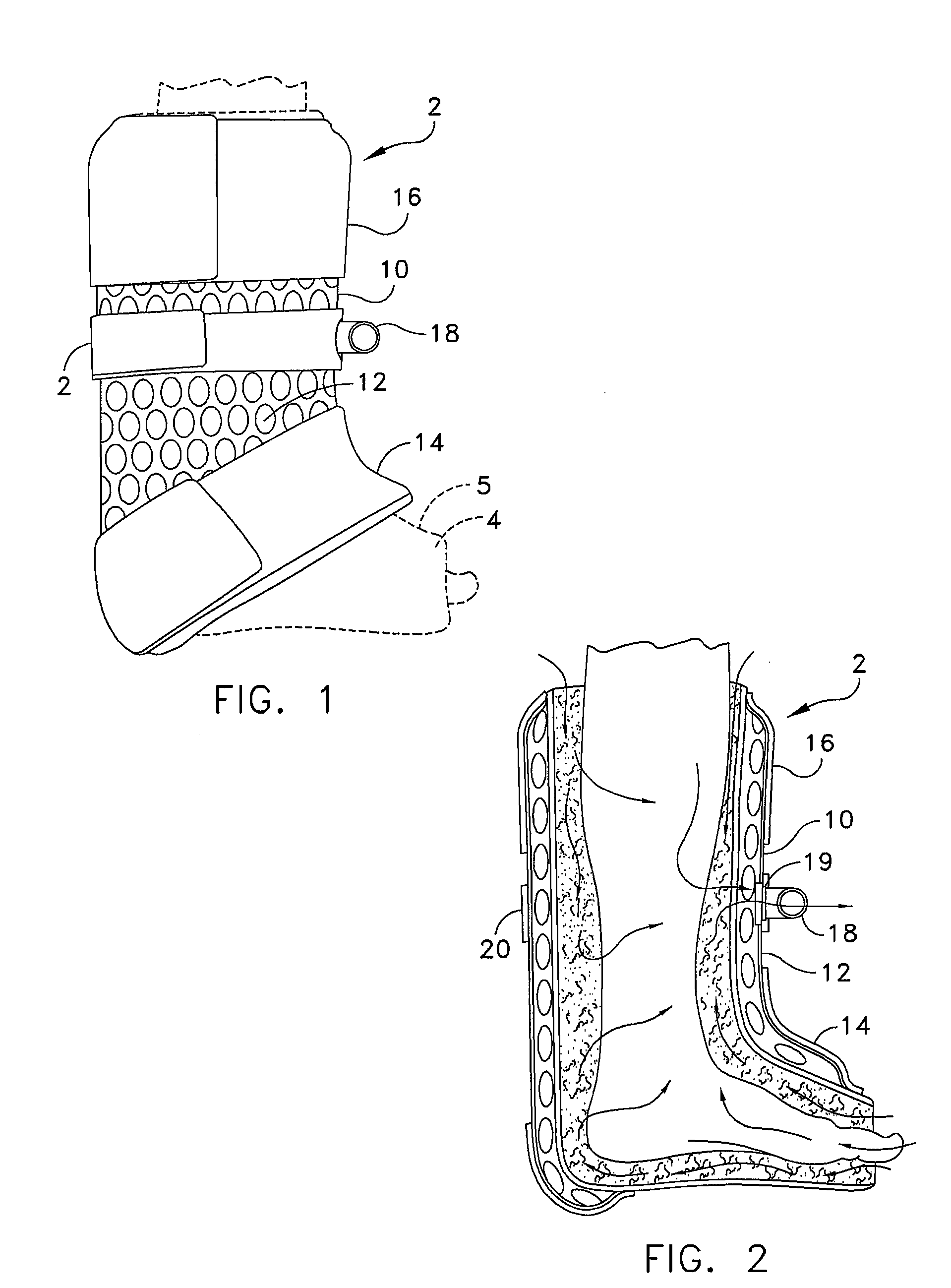 Apparatus and method of creating airflow through a breathable orthopedic cast