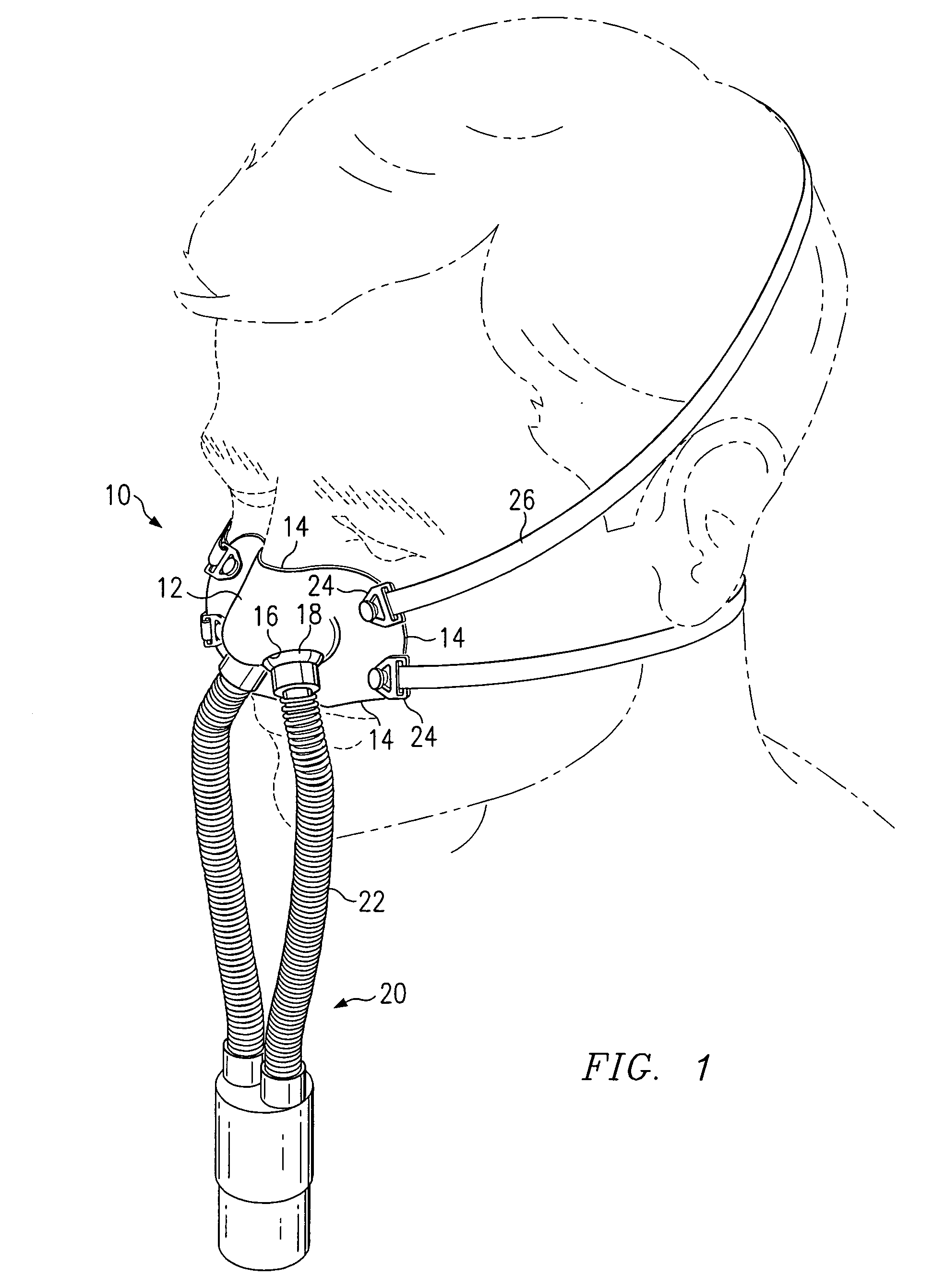 Custom fitted mask and method of forming same