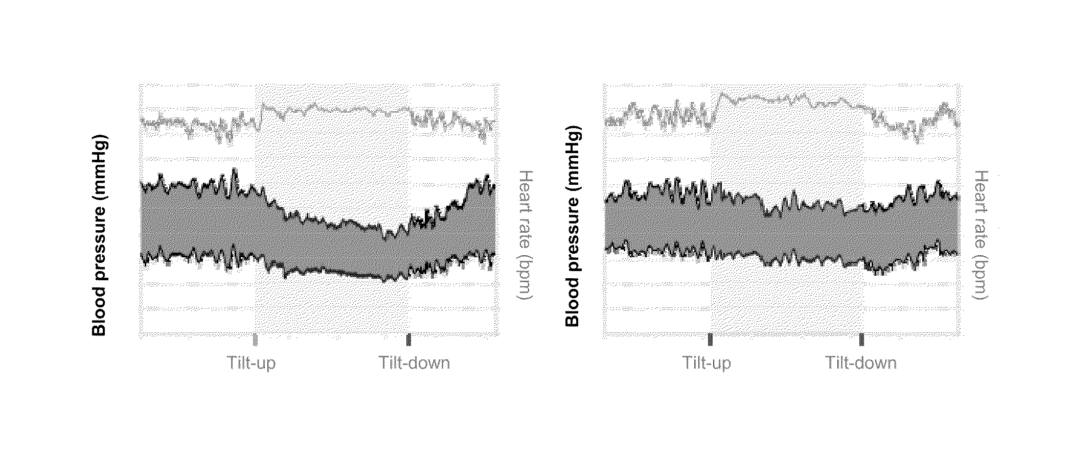 Methods and materials for treating orthostatic hypotension or postural tachycardia syndrome