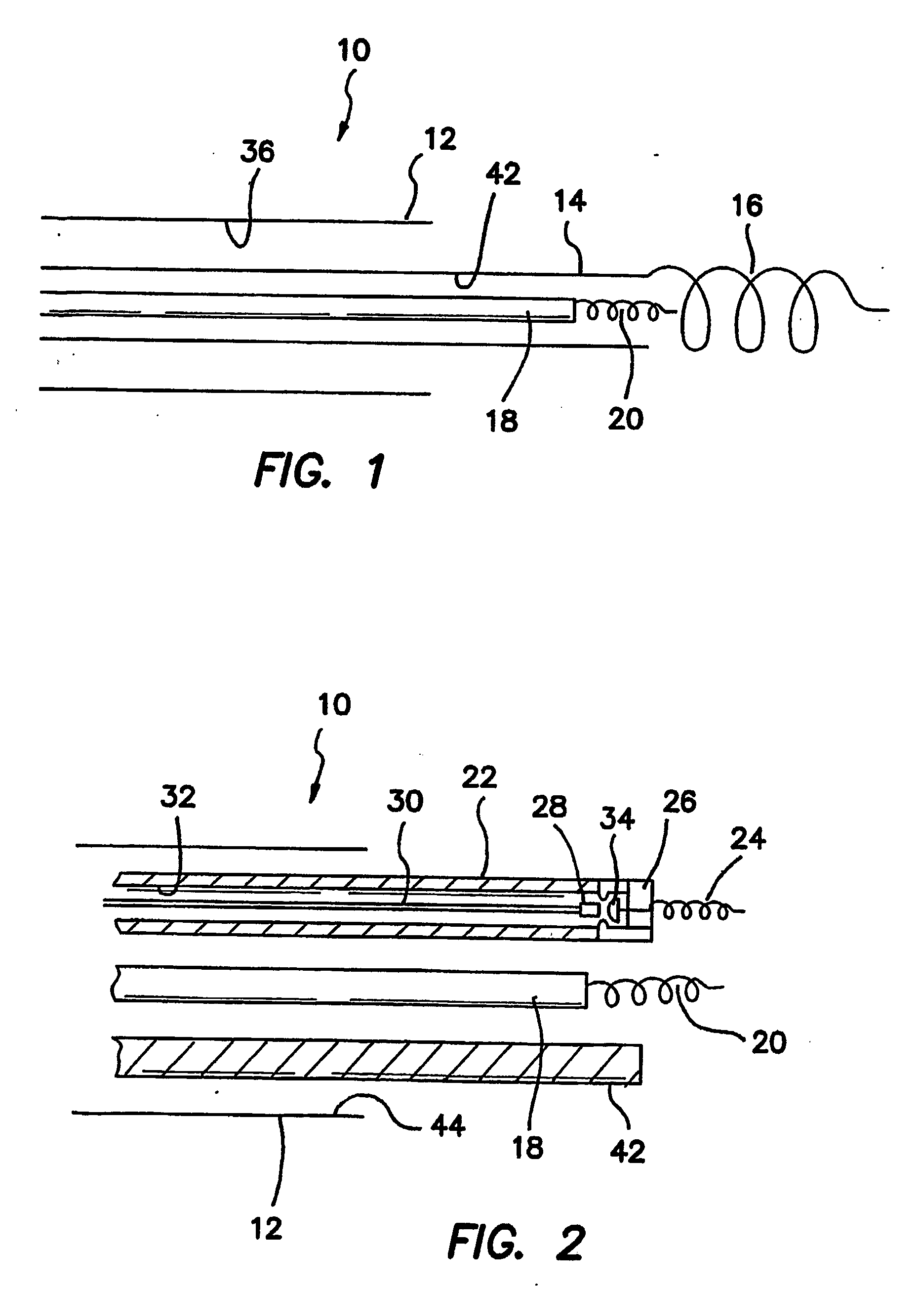 Method and apparatus for anchoring of pacing leads