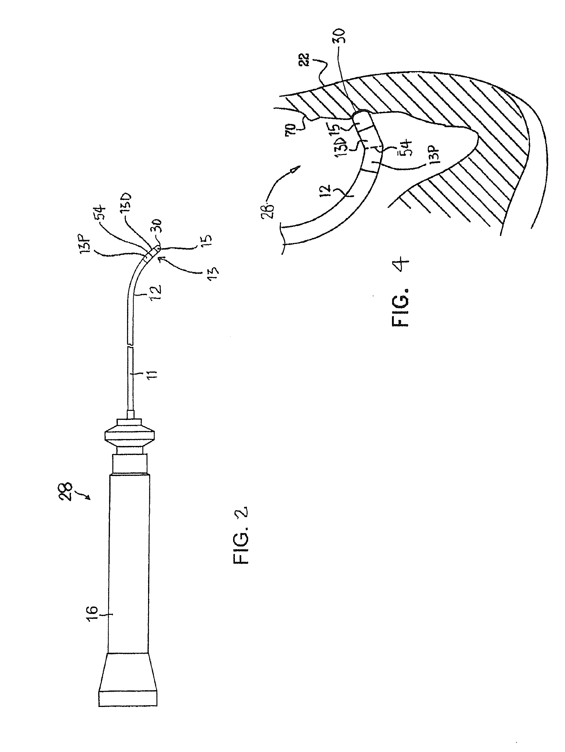 Catheter with serially connected sensing structures and methods of calibration and detection