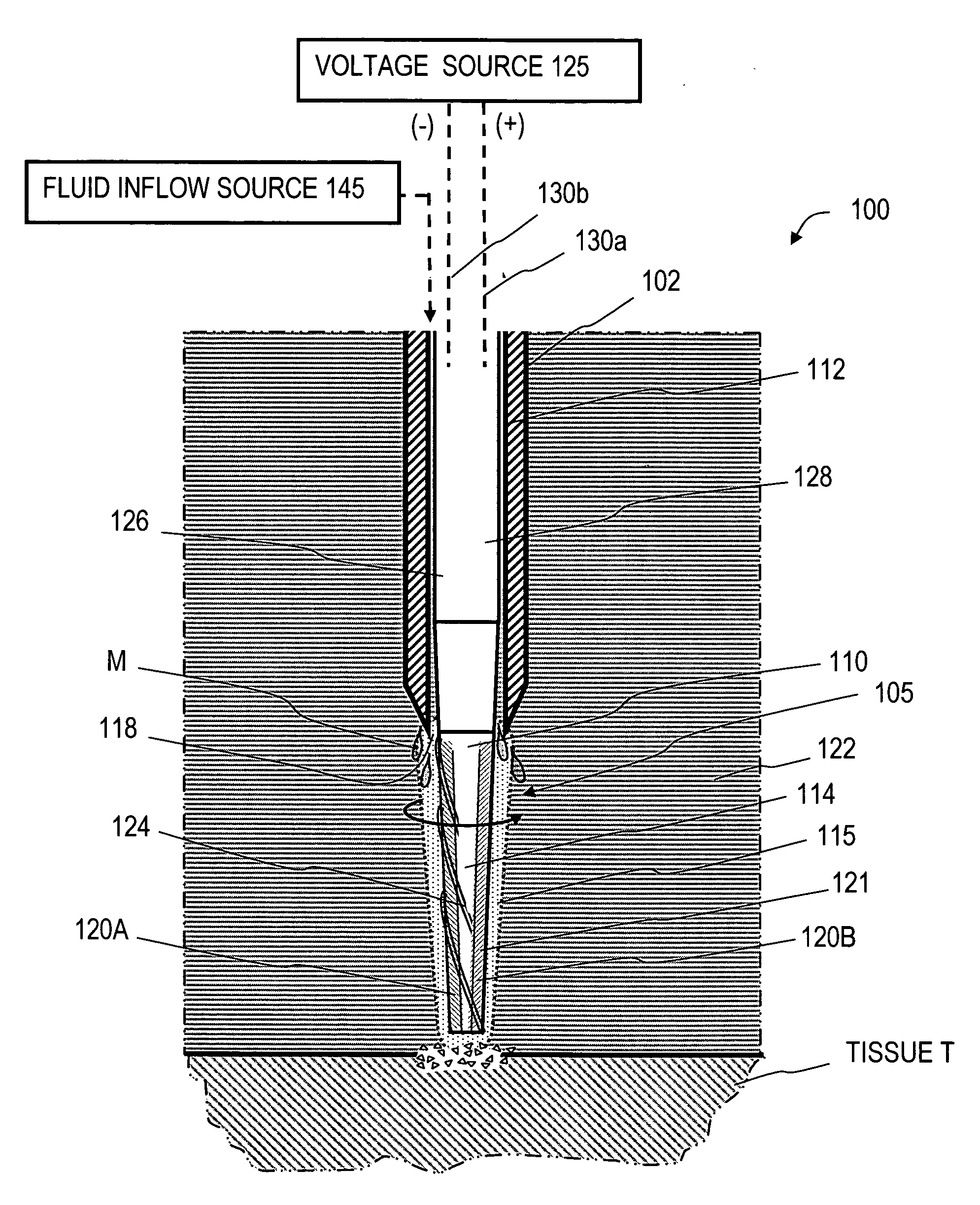 Supercavitating medical probe and method of use