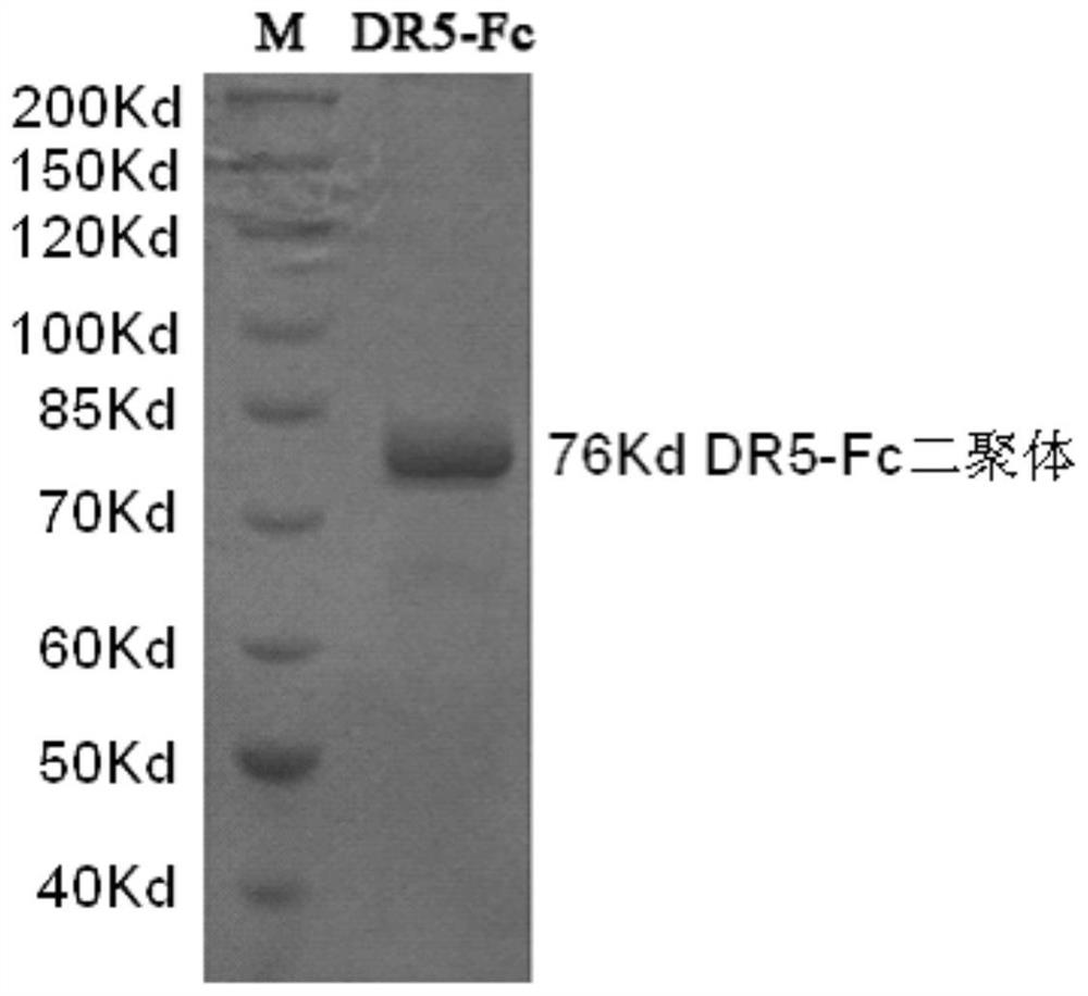 Application of human sDR5-Fc recombinant fusion protein in preparation of medicine for preventing and treating myocardial infarction and ischemia reperfusion injury