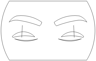 TM direct fixation method double-eyelid operation