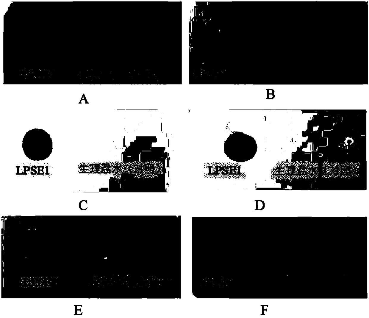 Salmonella phage and phage antibacterial composition and application thereof