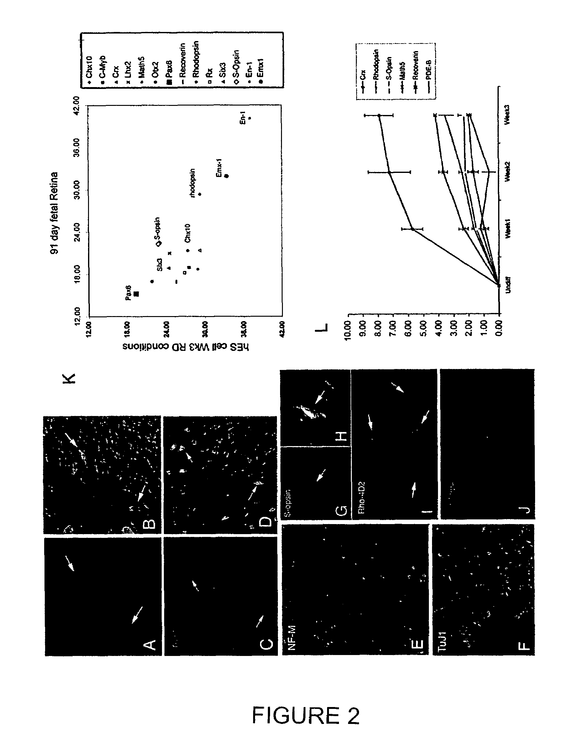 Method of generating human retinal progenitors from embryonic stem cells