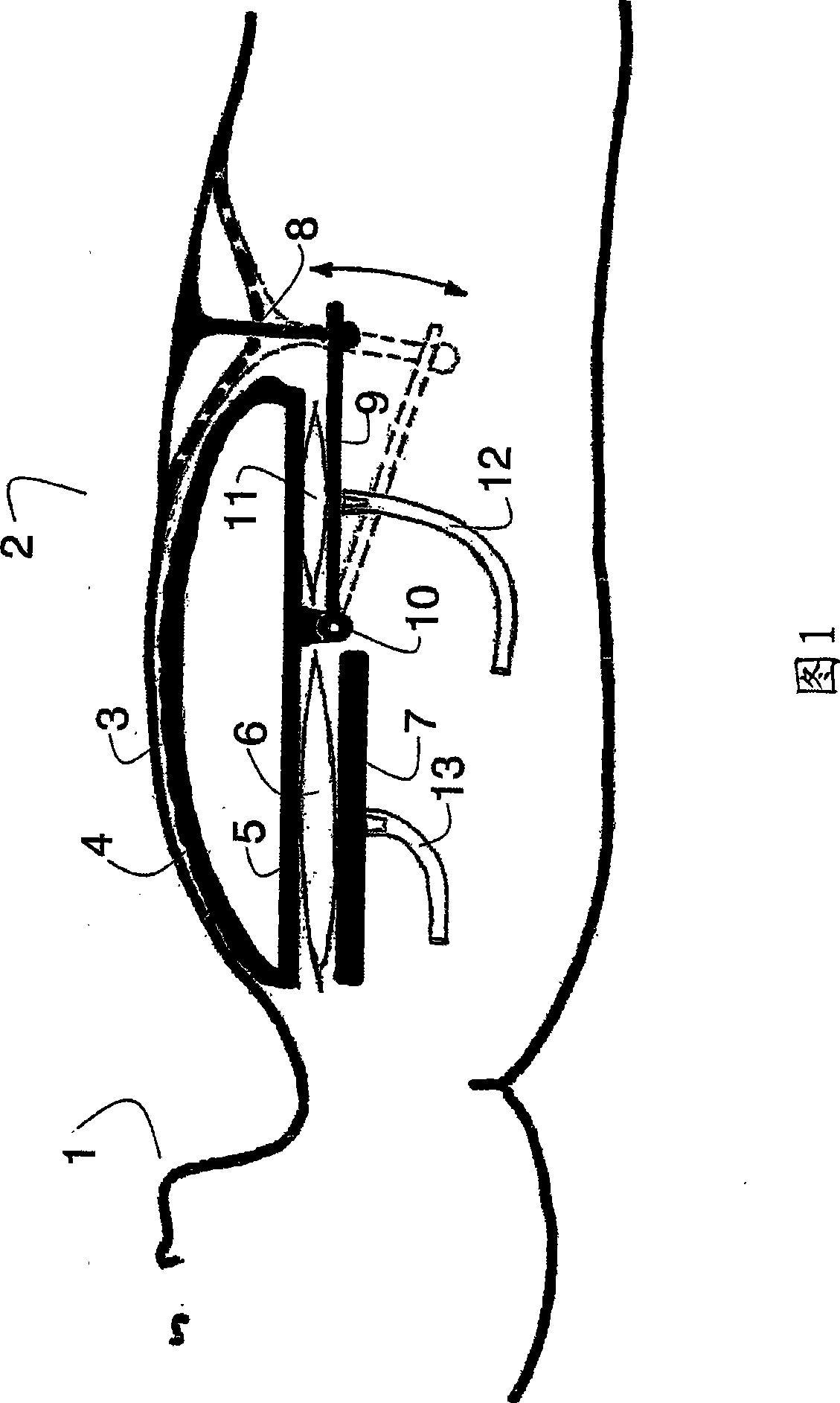 Chest retraction simulating device and medical patient simulator having the device