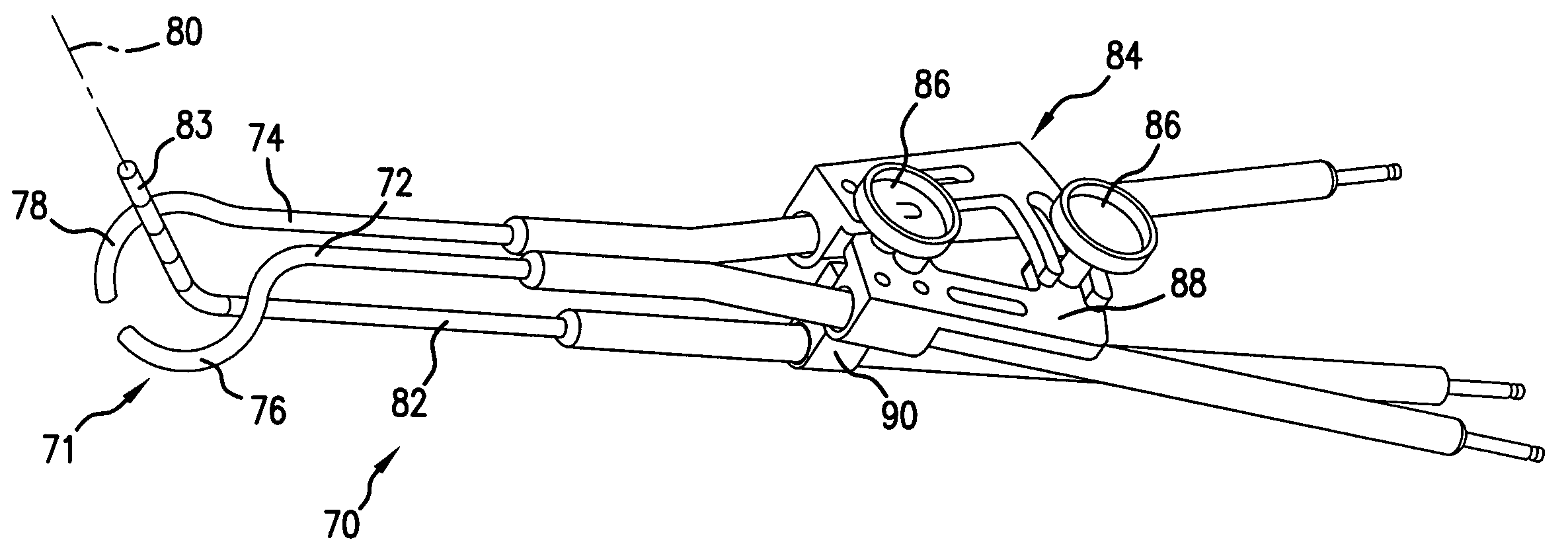 Split-ring brachytherapy device and method for cervical brachytherapy treatment using a split-ring brachytherapy device