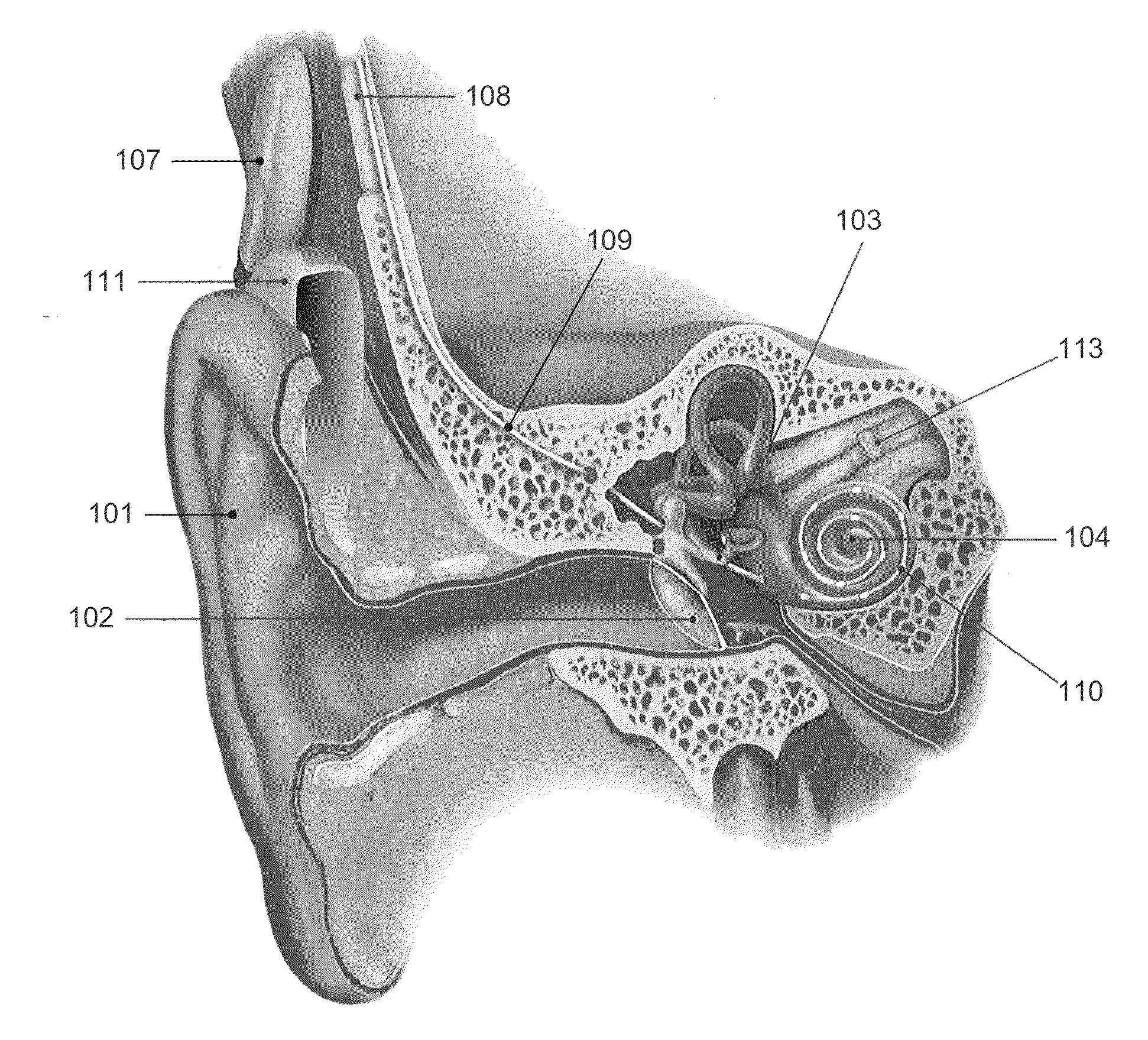 Cochlear Implant Stimulation with Low Frequency Channel Privilege