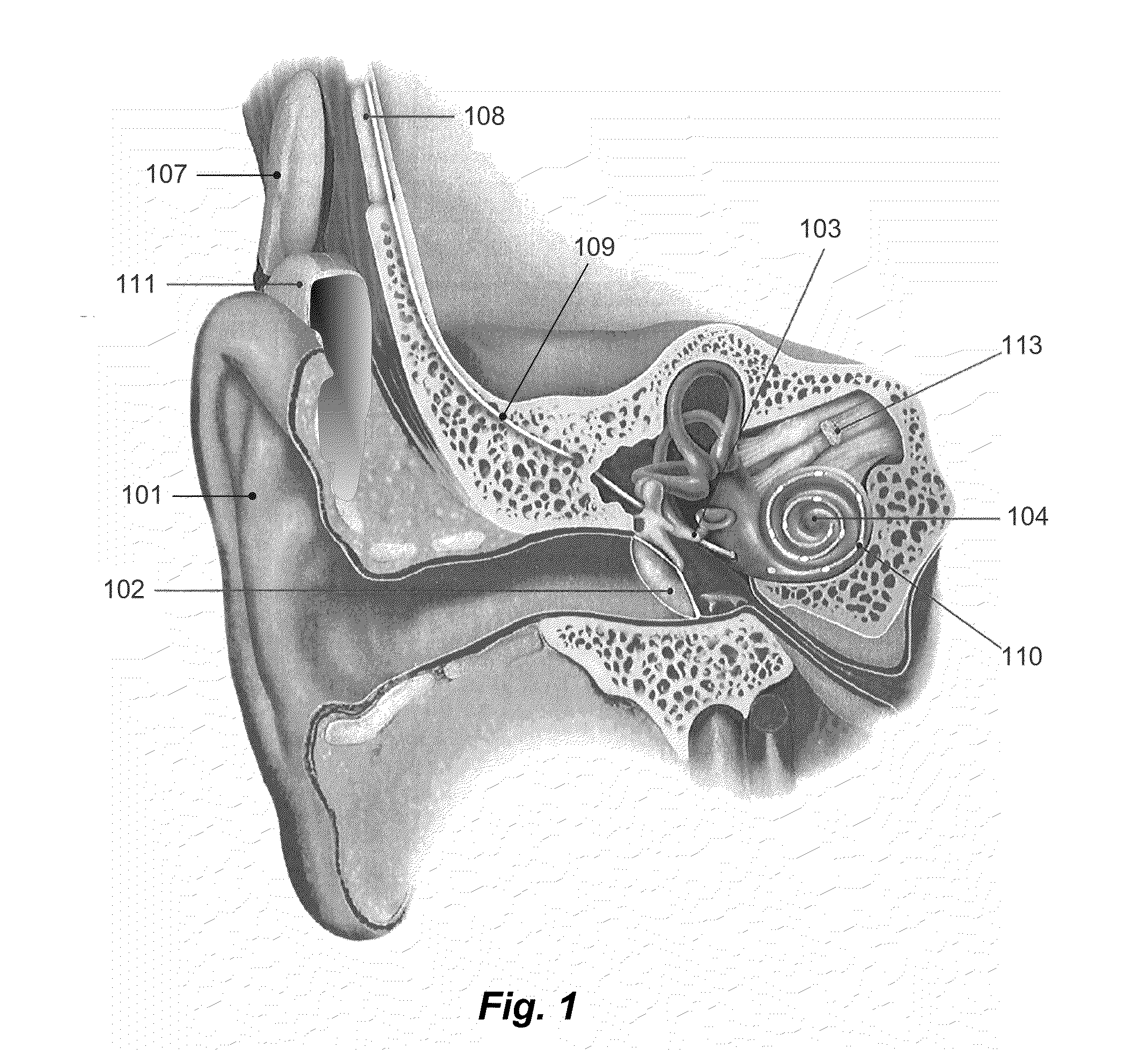 Cochlear Implant Stimulation with Low Frequency Channel Privilege