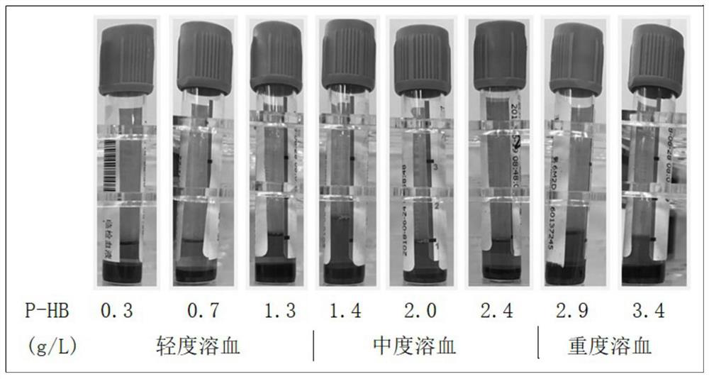 A method for correcting the influence of hemolysis on the detection of red blood cell series parameters