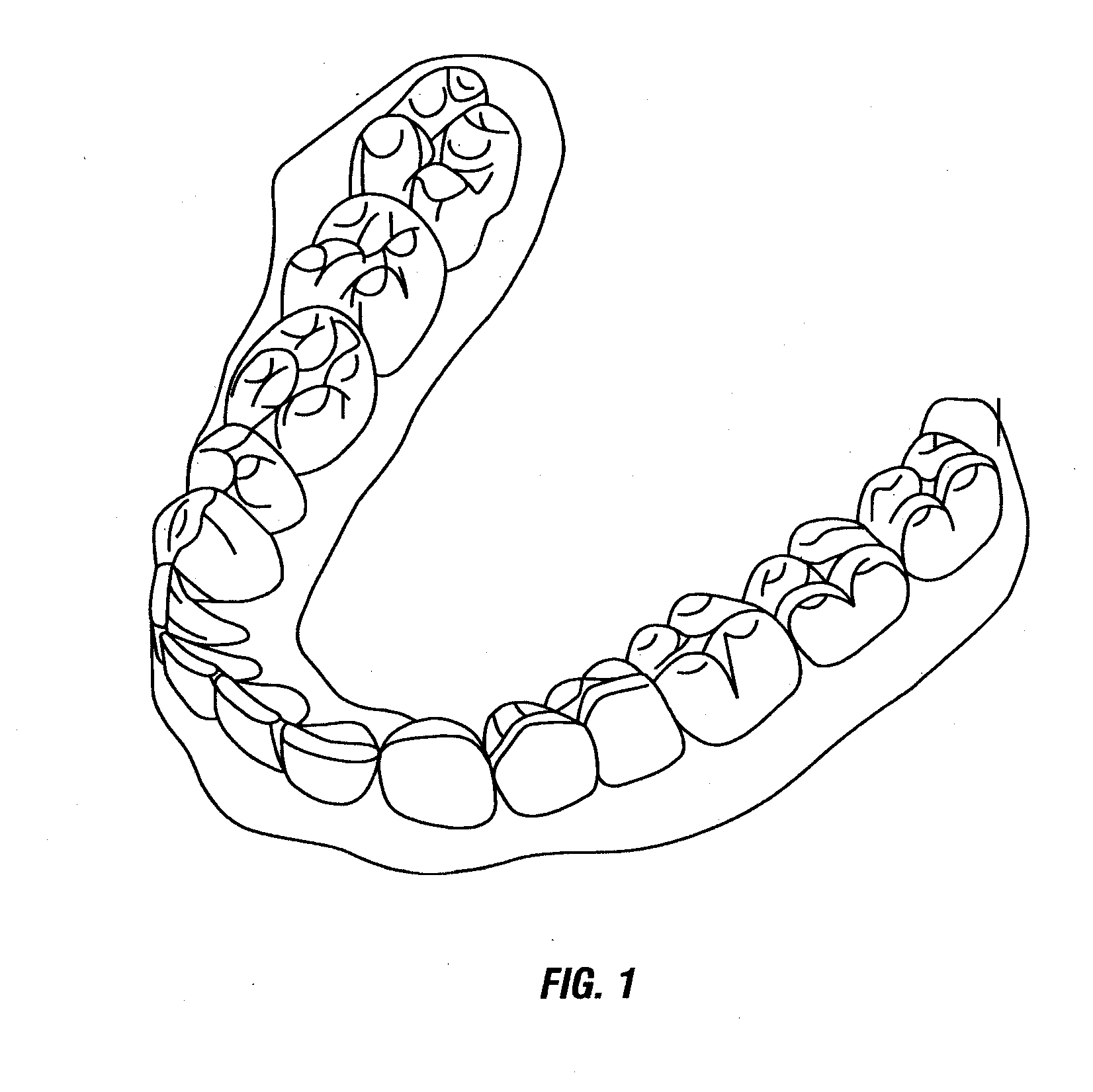 Dental models and series of dental models, and methods and apparatus for making and using same