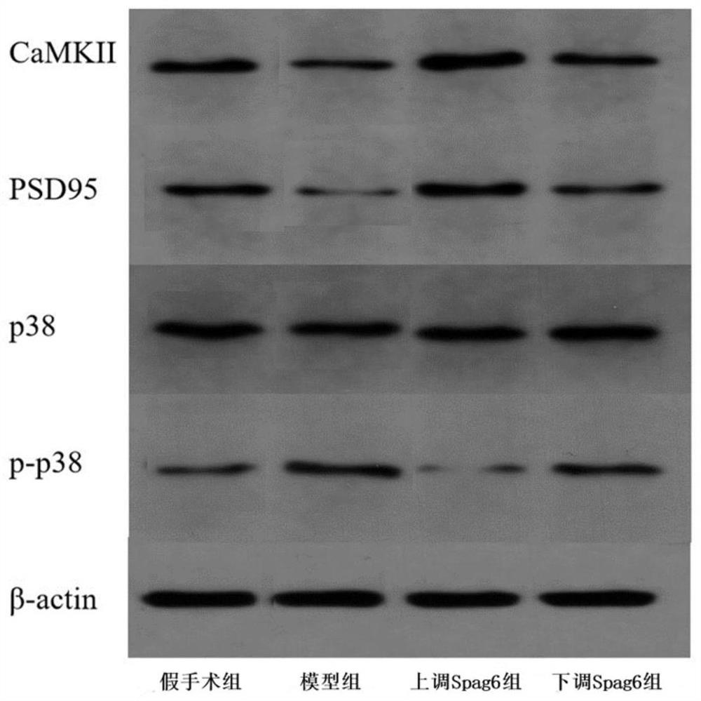 Application of Spag6 in preparation of medicine for relieving cerebral arterial thrombosis reperfusion mediated synaptic injury