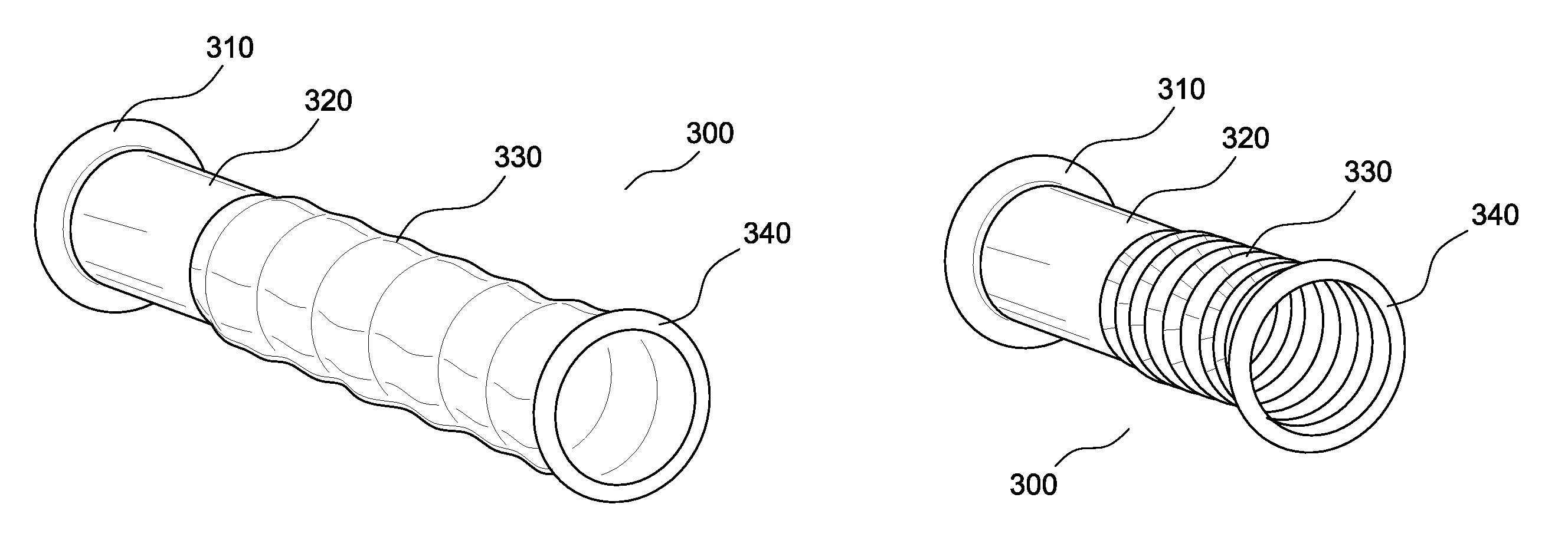 Applicator, assembly, and method for connecting an inlet conduit to a hollow organ