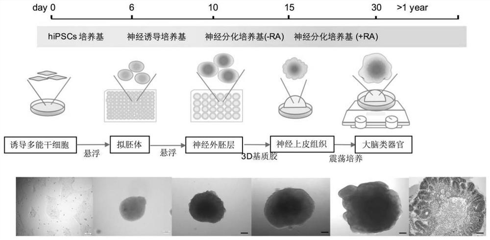 Construction method and application of glioblastoma organoid model