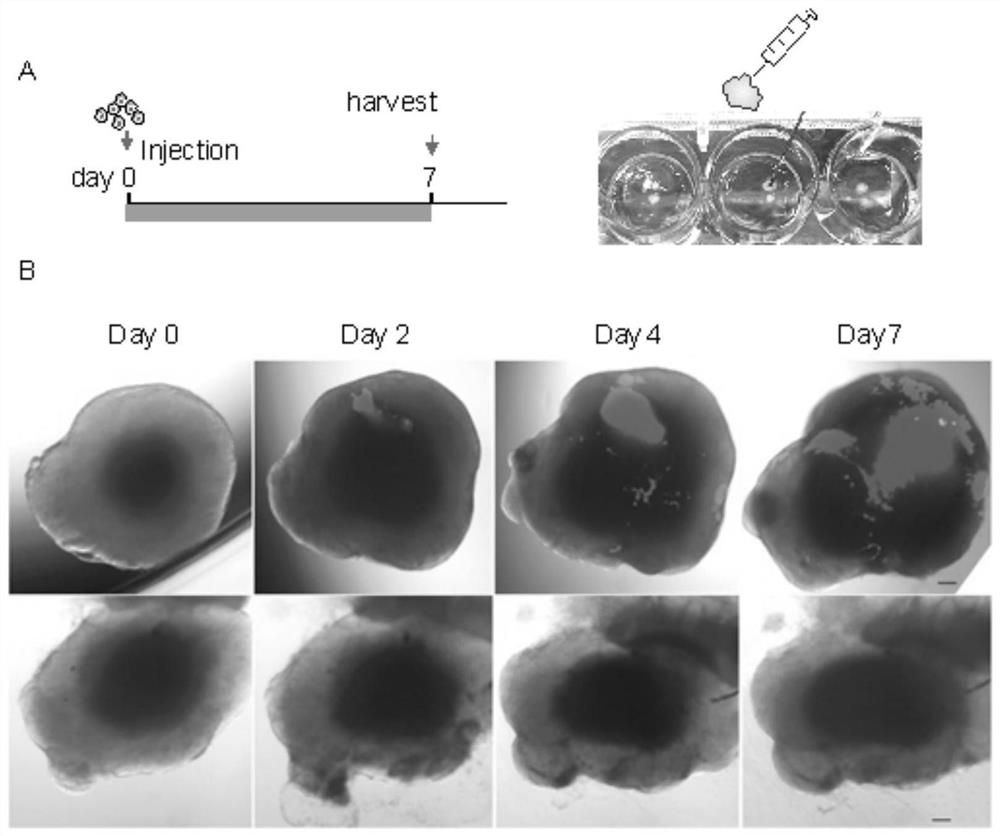 Construction method and application of glioblastoma organoid model