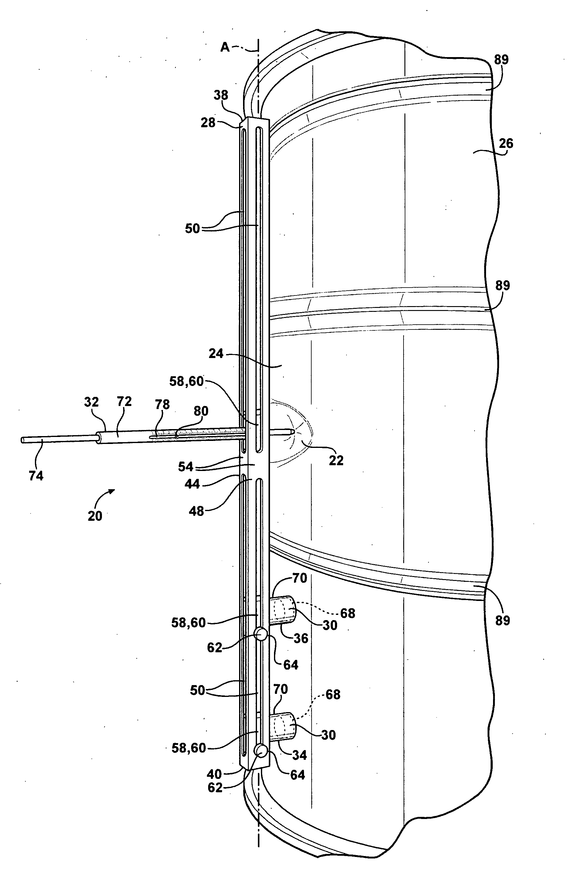 Method Of Measuring Dents And Method Of Classifying Dents