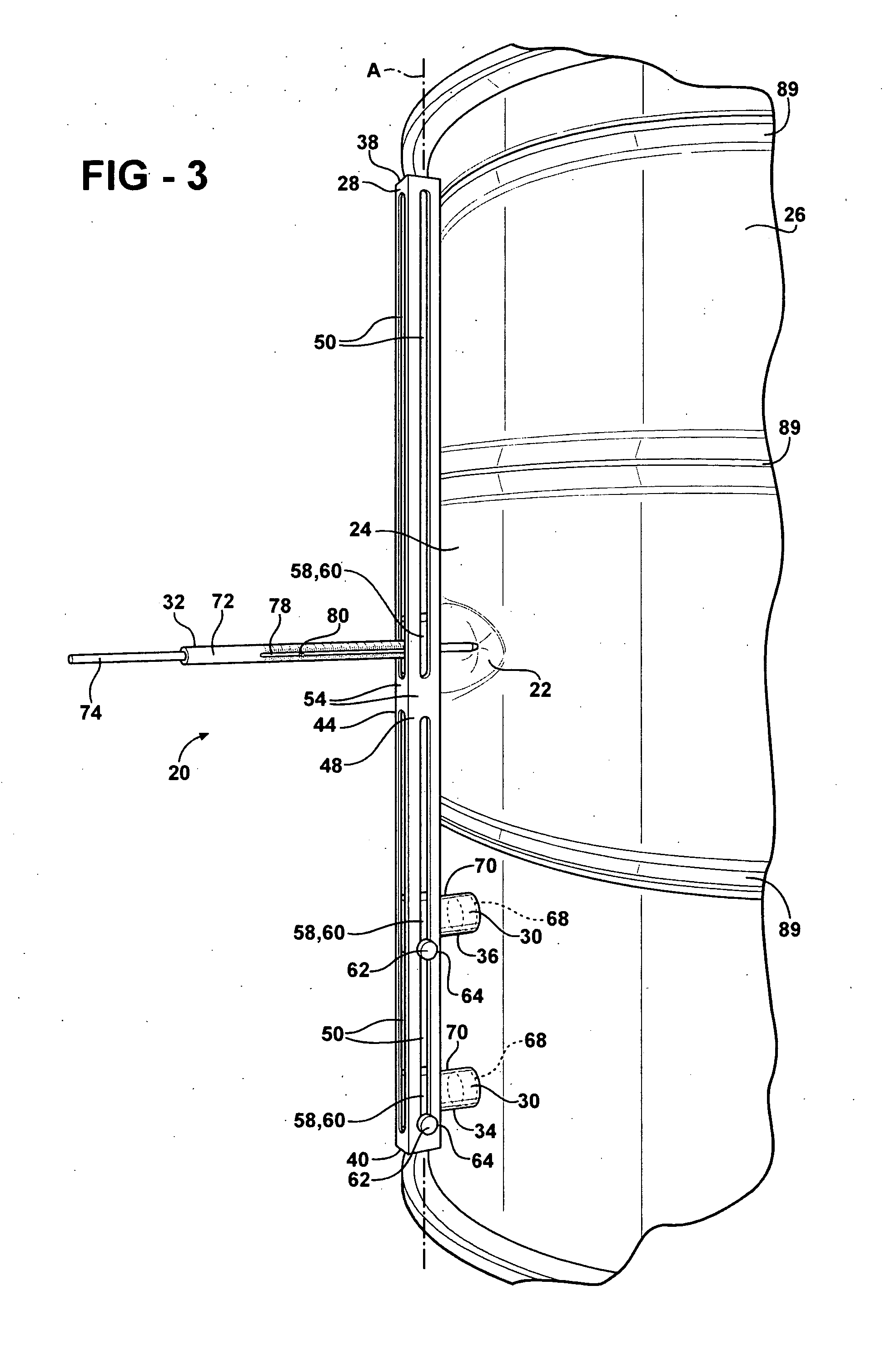 Method Of Measuring Dents And Method Of Classifying Dents