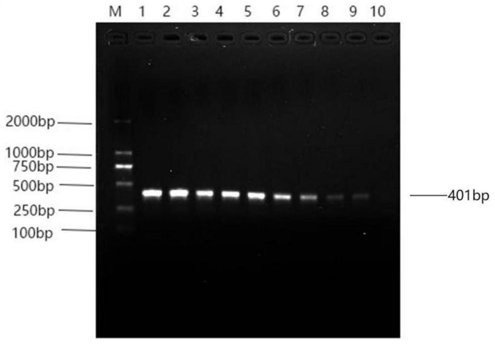 A kind of specific primer, method and application for detecting Acinetobacter towneri