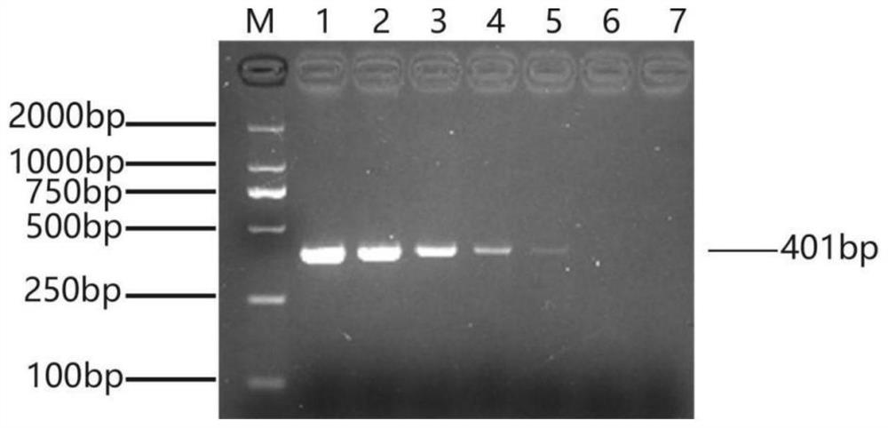 A kind of specific primer, method and application for detecting Acinetobacter towneri
