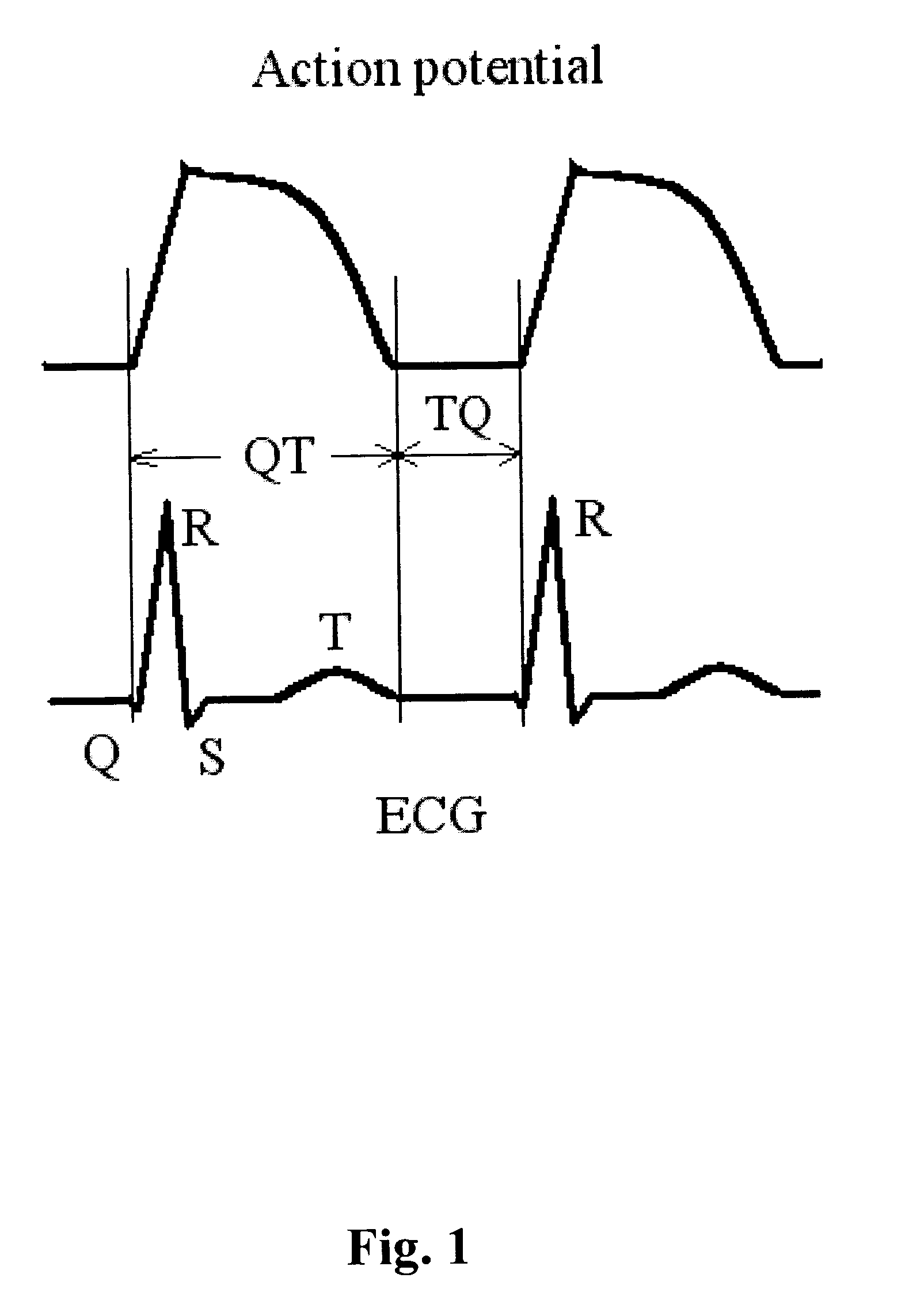 Method and system for evaluating cardiac ischemia based on heart rate fluctuations