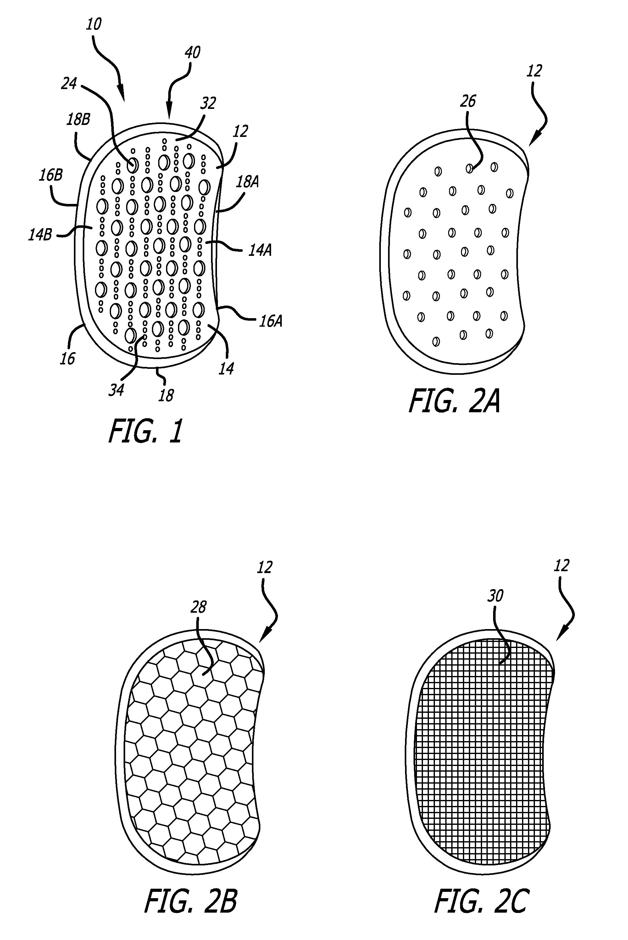 Joint support and subchondral support system