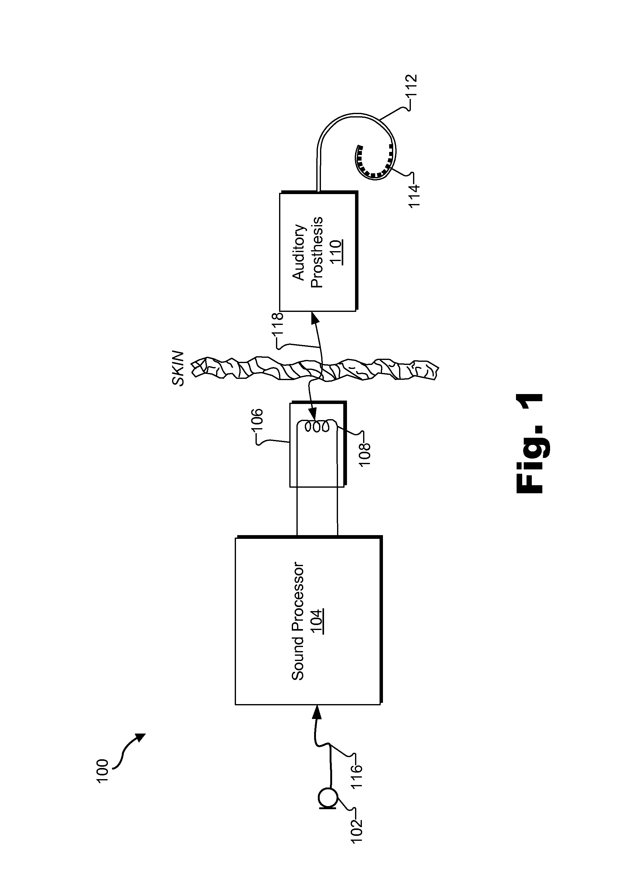 Systems and methods for facilitating time-based fitting by a sound processor