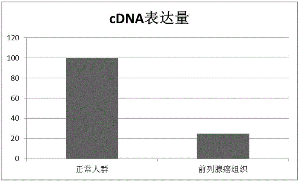 Prostatic cancer diagnosis product and application thereof