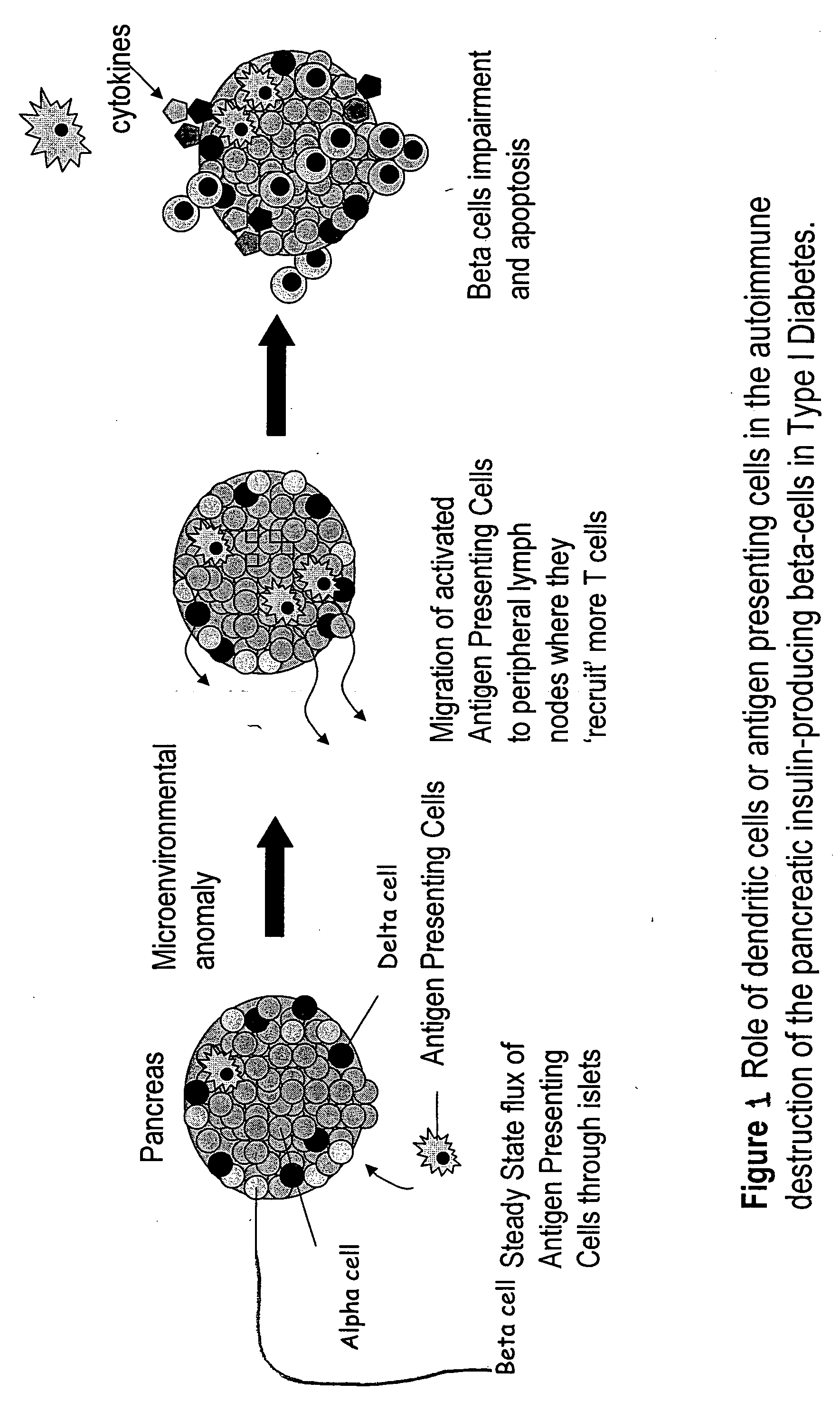 Delivery of as-oligonucleotide microspheres to induce dendritic cell tolerance for the treatment of autoimmune type 1 diabetes