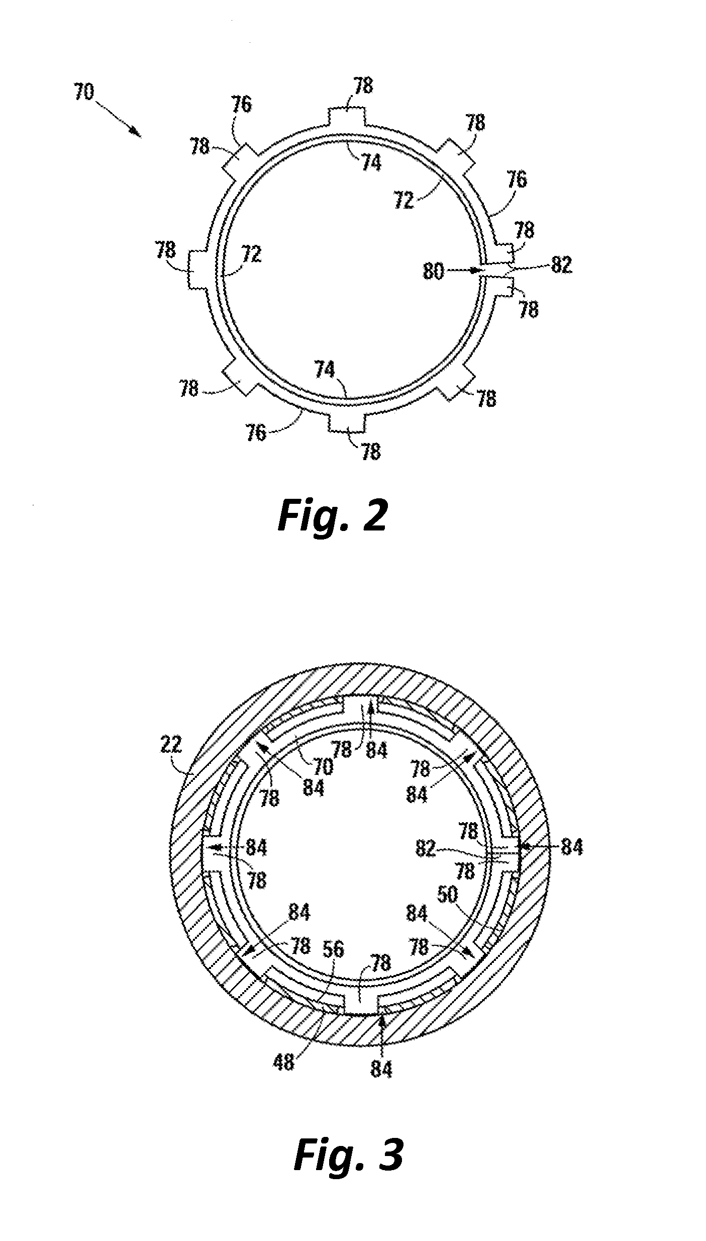 Downhole Tool with Collapsible or Expandable Split Ring