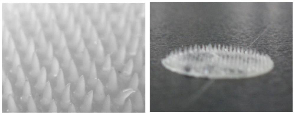 Preparation method of exenatide microneedle