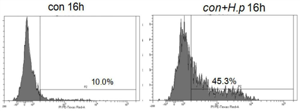 Application of gsdmd inhibitor in preparation of medicine for treating helicobacter pylori infection