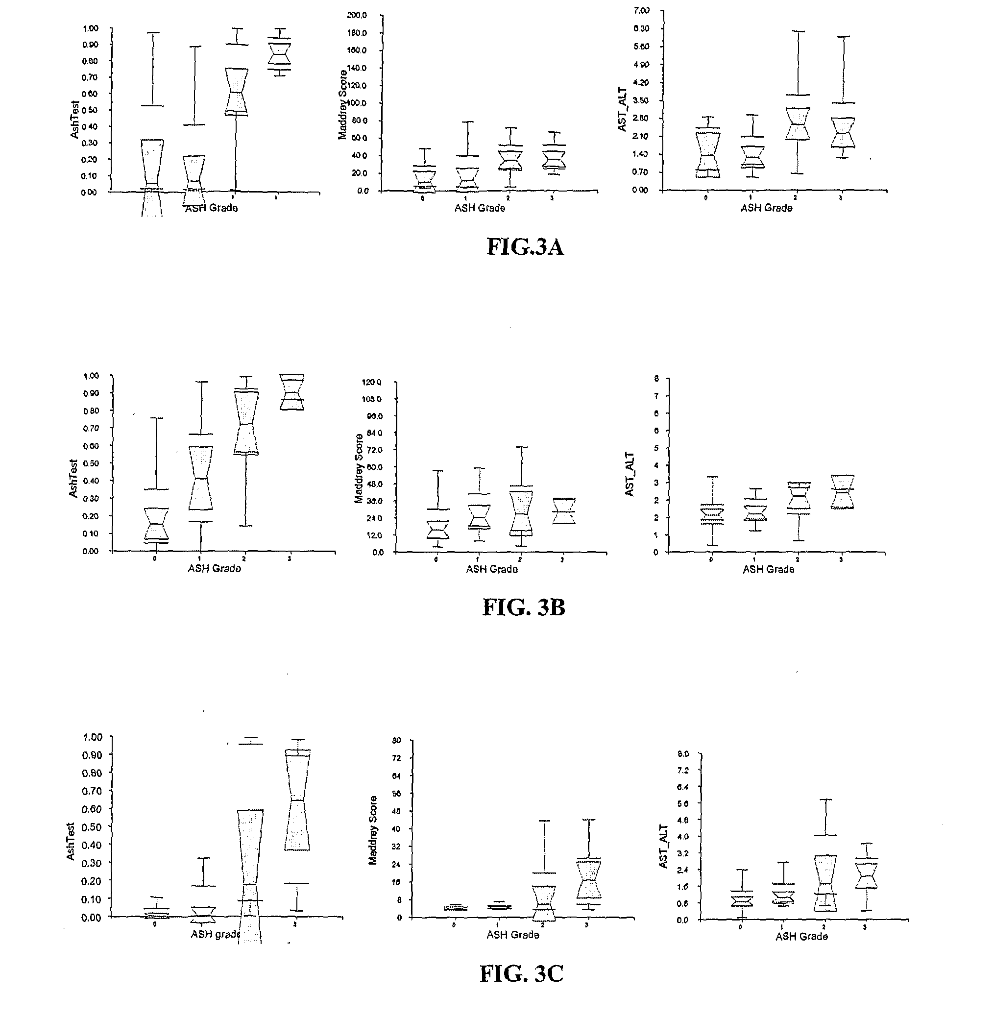 Diagnosis Method Of Alcoholic Or Non-Alcoholic Steato-Hepatitis Using Biochemical Markers