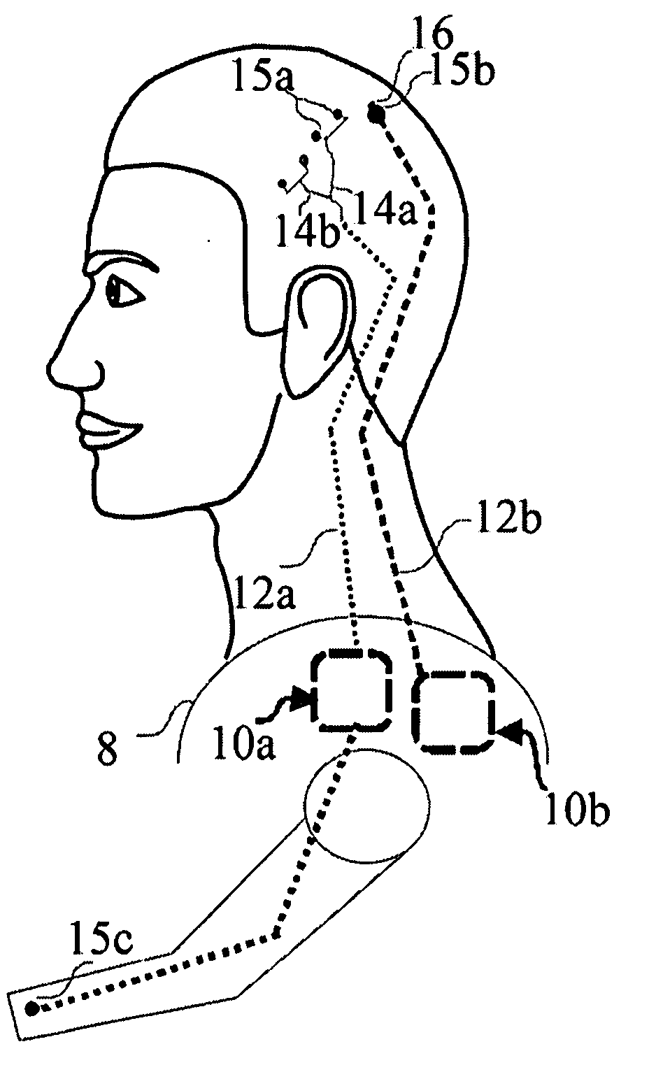 Methods and Systems for semi-automatic adjustment of medical monitoring and treatment