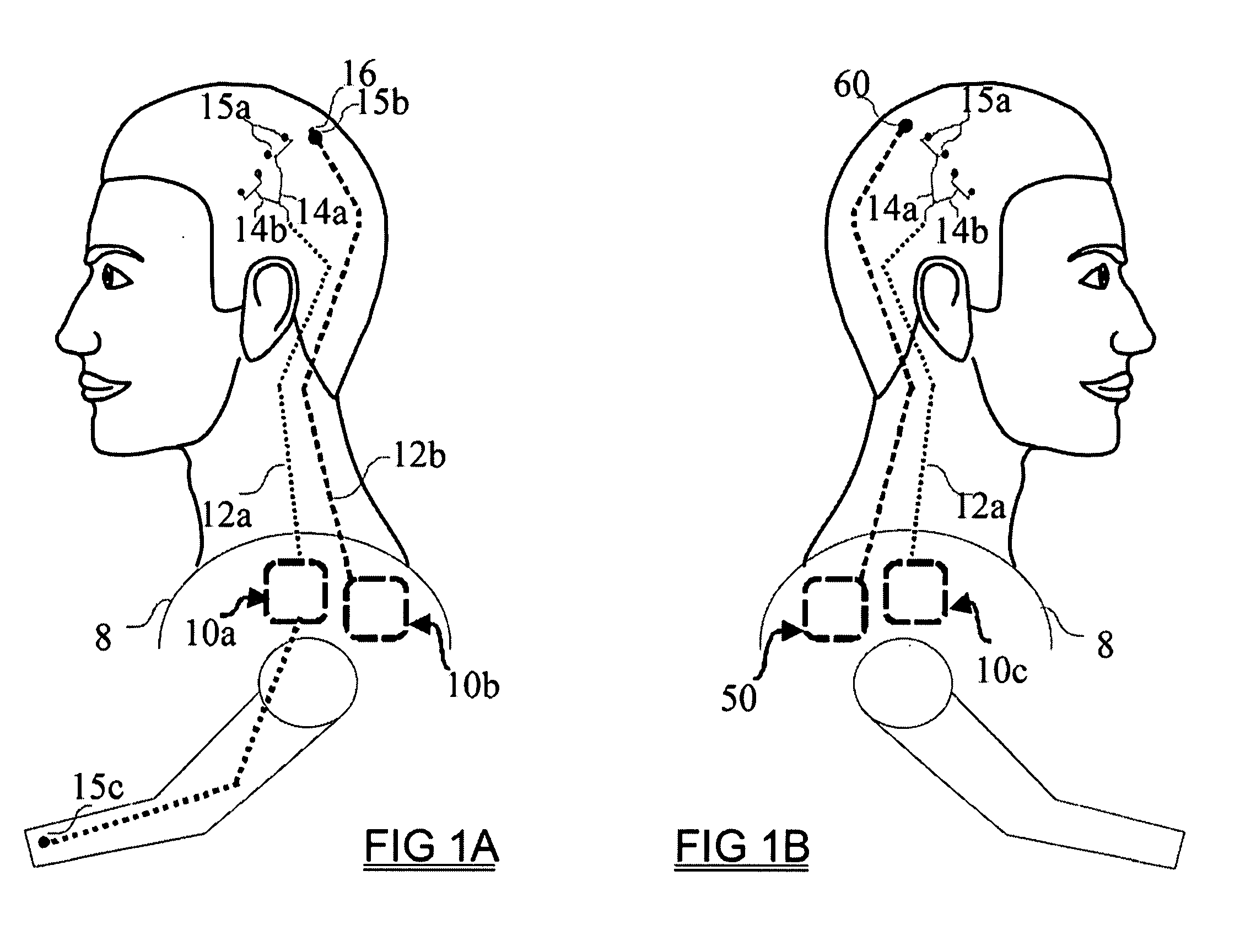 Methods and Systems for semi-automatic adjustment of medical monitoring and treatment