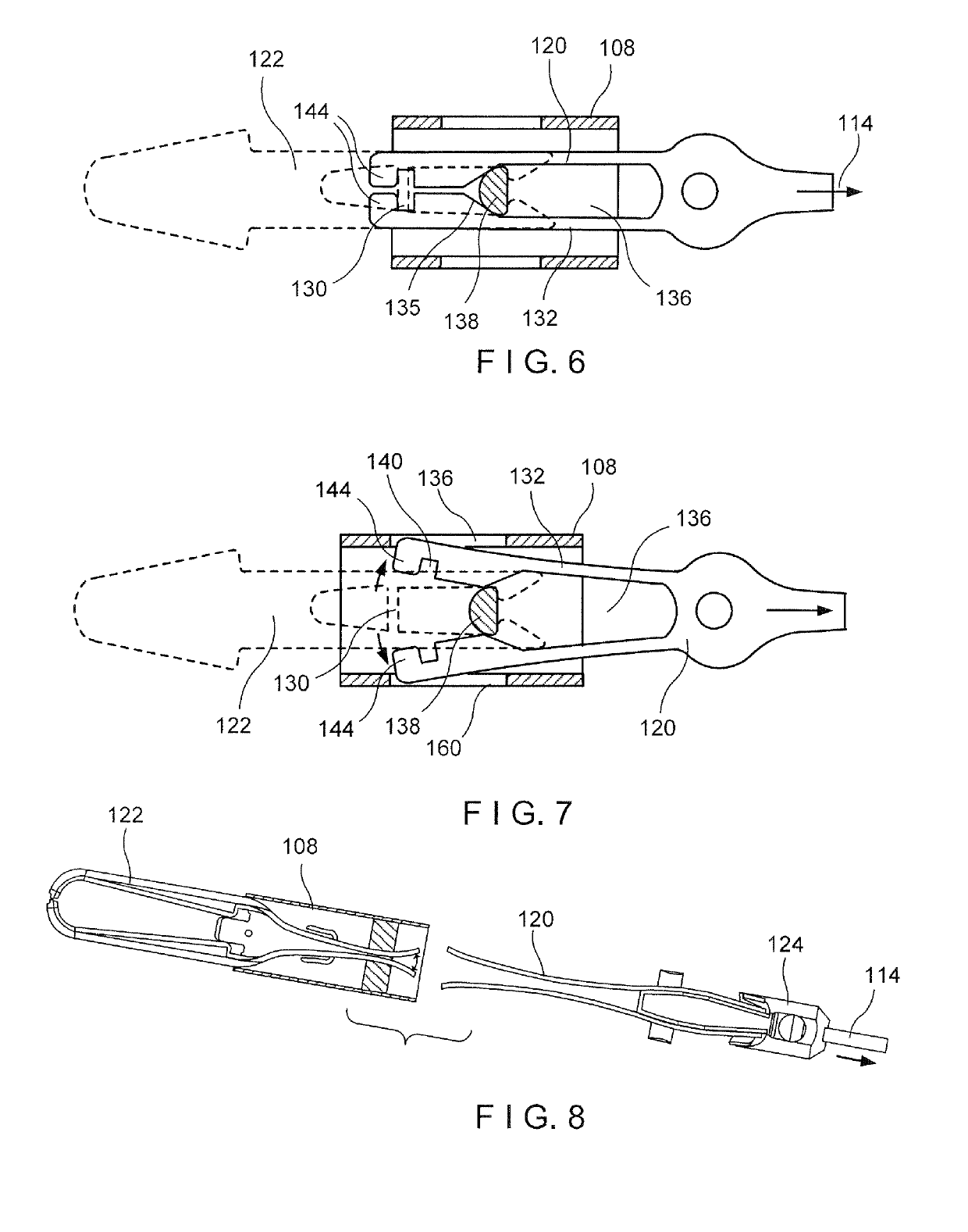 Hemostasis clip