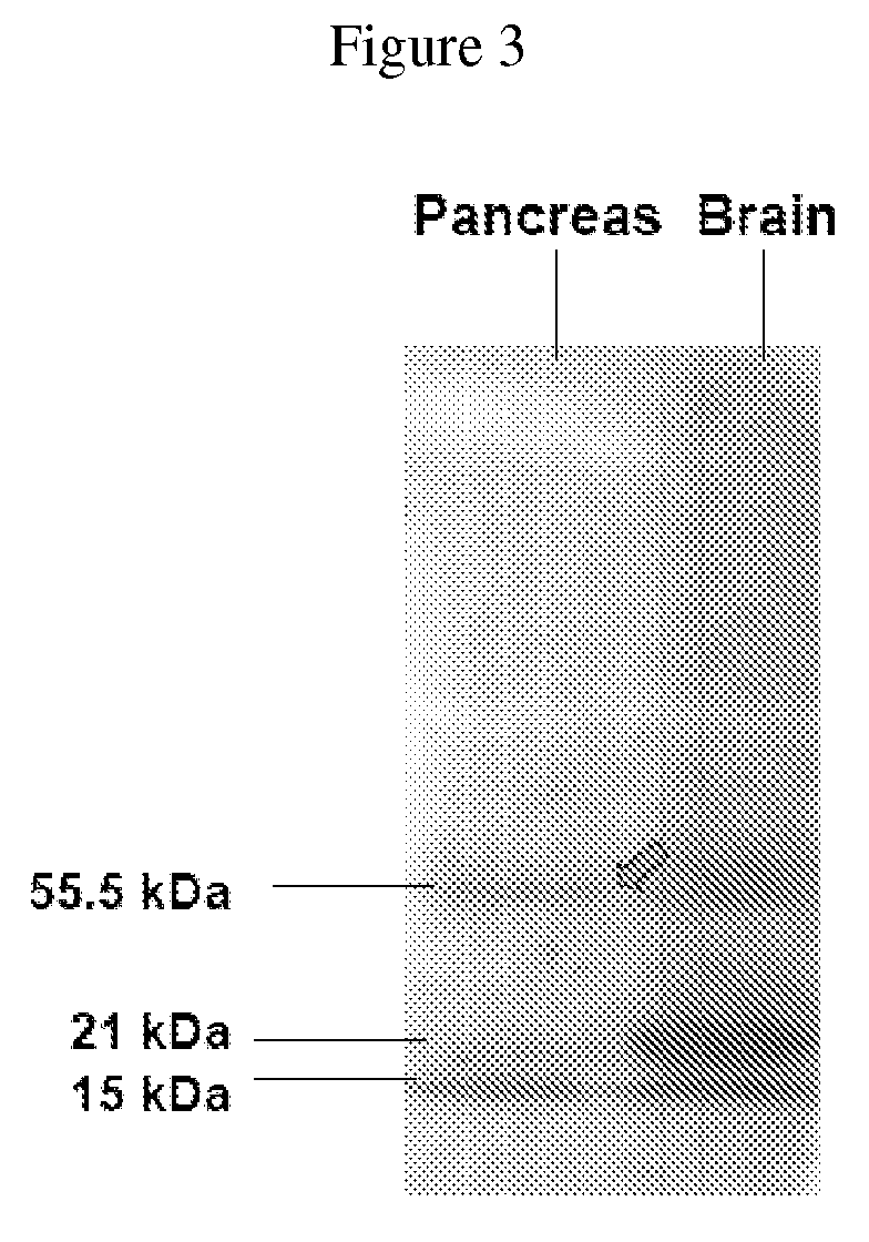Methods and compositions for preventing and/or treating pancreatitis