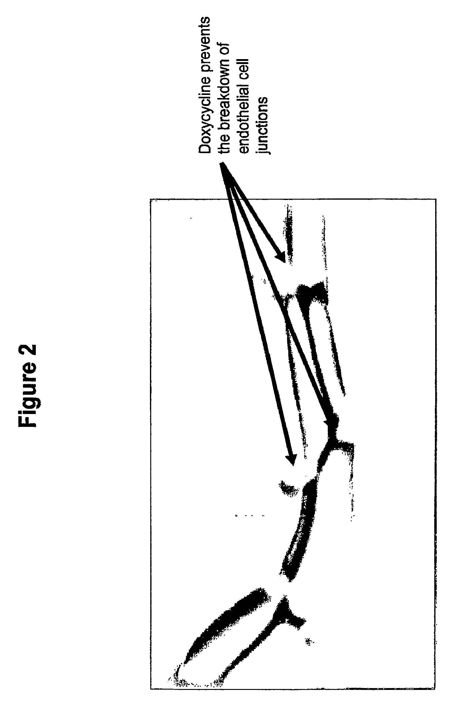 Tetracyclines for Treating Ocular Diseases and Disorders