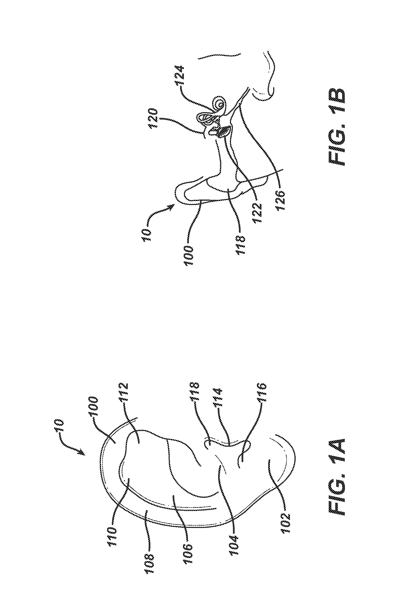 Personalizable system and method for anesthetizing the tympanic membrane