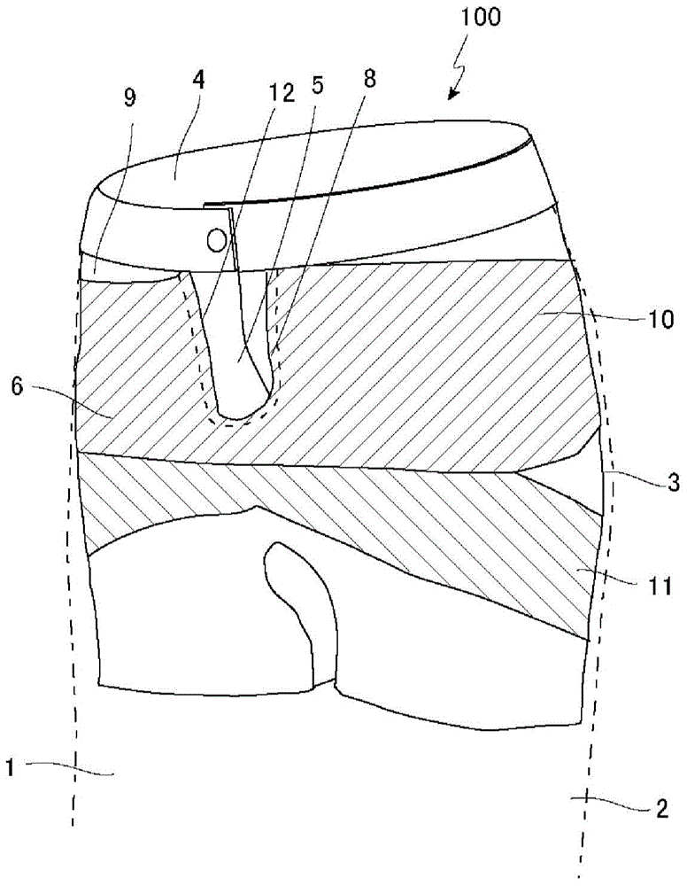 Trousers with orthopedic belts