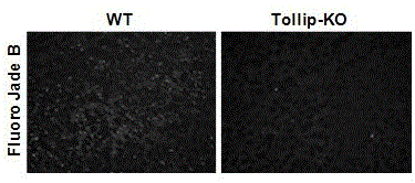 Application of toll-acting protein (tollip) in stroke