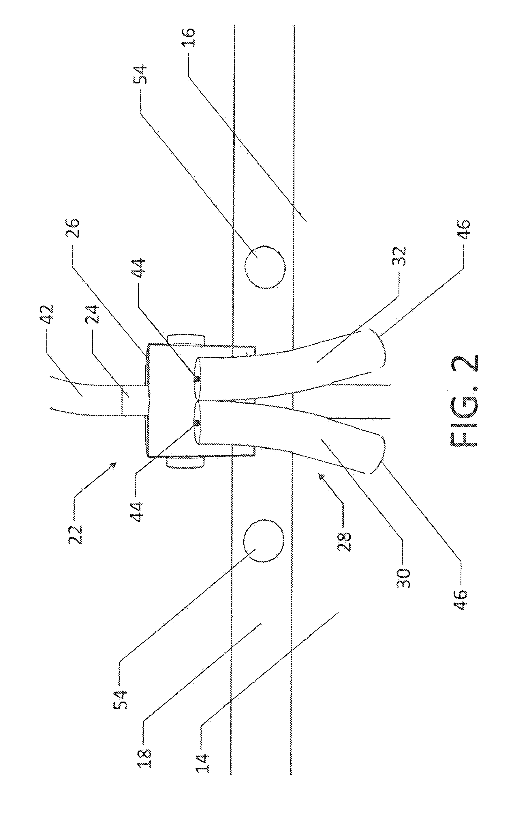 Selective-Capacity Bodily Fluids Collection and Drainage Device