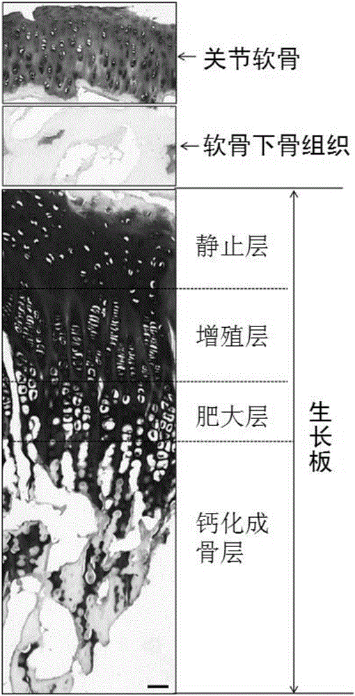 In-vitro construction method of epiphyseal plate cartilage