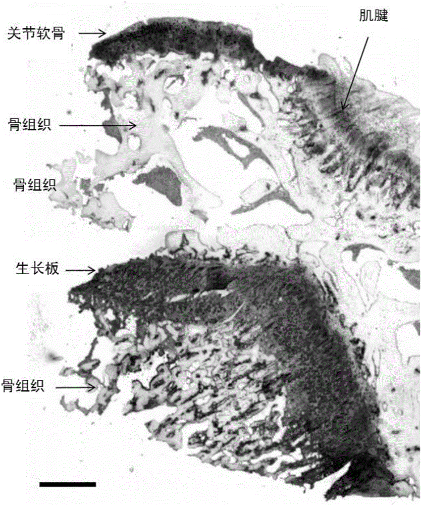 In-vitro construction method of epiphyseal plate cartilage